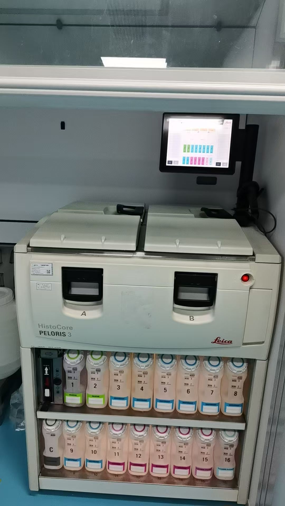 全自动双缸组织脱水机